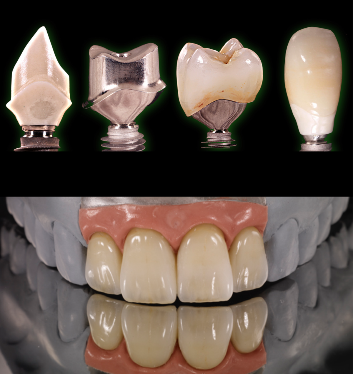 디지털 기공소(R2 Digital Laboratory) 에서 기공인력을 채용합니다.